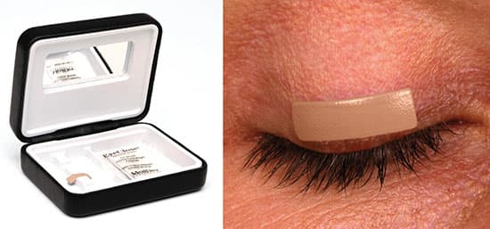 External eyelid weight applied to the upper eyelid for lagophthalmos